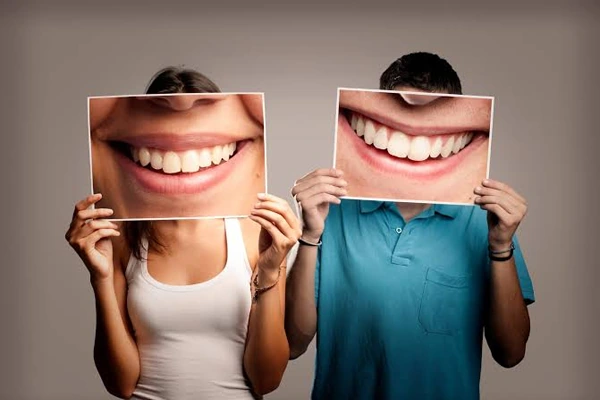 tipos de sonrisa que debes saber