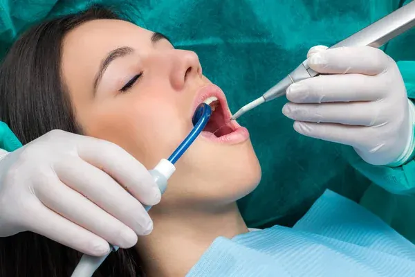 Cada cuánto tiempo es recomendable realizar una limpieza dental