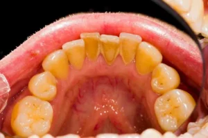 sarro dental