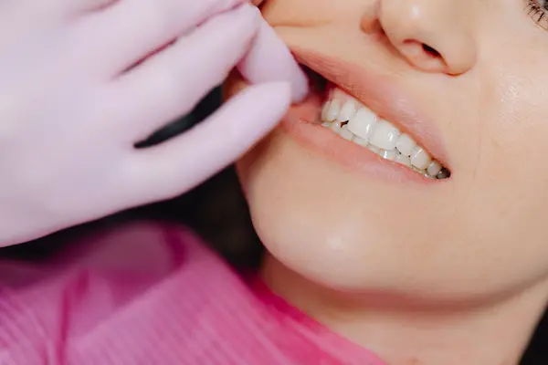 ¿Qué puedo hacer si sospecho que rechino los dientes?